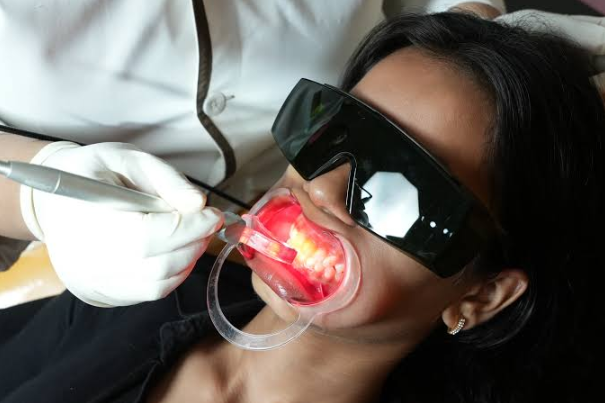 Laser Dentistry For Nervous Patients: Questions To Bring To Your Appointment